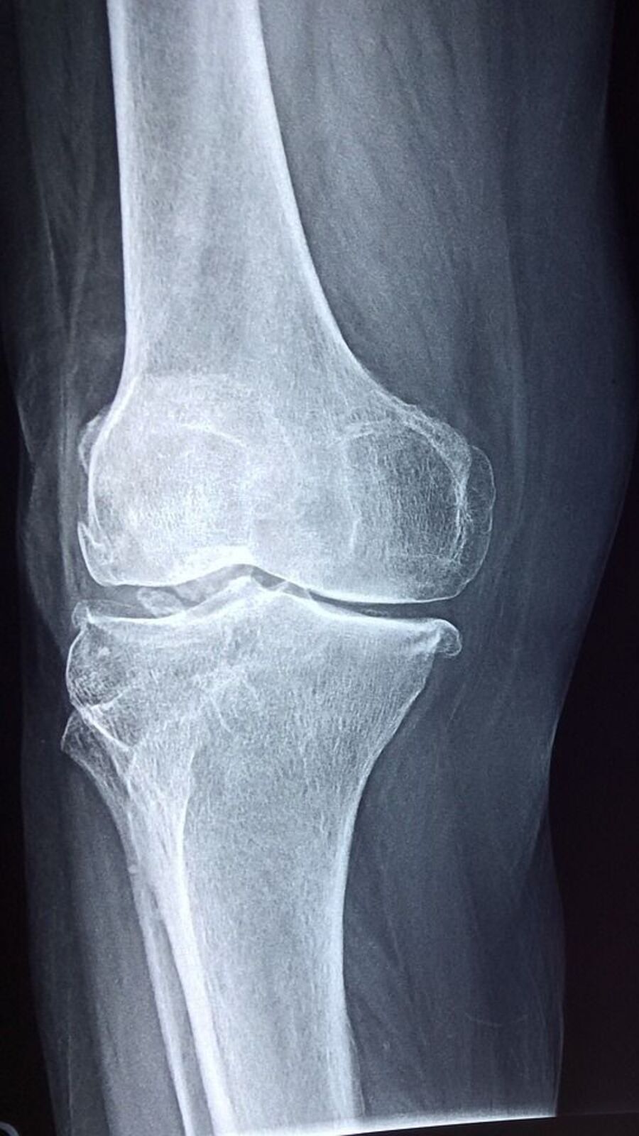 Joint Problem Prevention: গাঁটে ব্যথা হয়? এই অভ্যাসগুলি থাকলে, ব্যথামুক্ত হতে পারবেন সহজেই