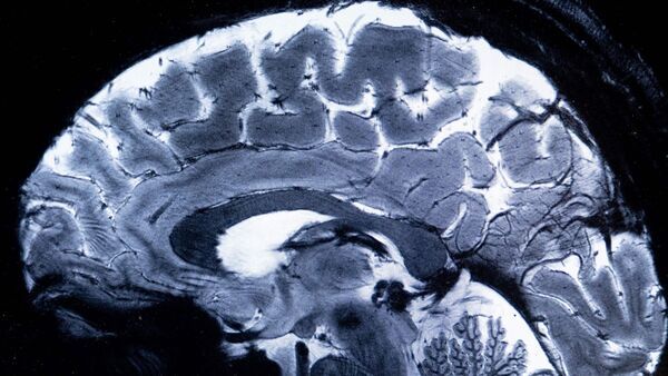 বিশ্বের সবচেয়ে শক্তিশালী MRI স্ক্যান মেশিন থেকে বেরিয়ে এল মানব মস্তিষ্কের ছবি