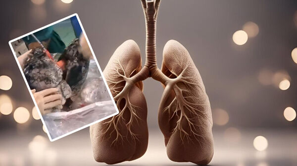 Creepy Video of Smoker’s Lungs: ধূমপান করলে ফুসফুসটা কেমন দেখতে হয়ে যায় জানেন? ভয়ে শিউড়ে উঠতে পারেন