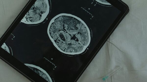 Brain Function: আমরা জেগে থাকলে মস্তিষ্কের এই অংশ ঘুমোয়, আর ঘুমোলে জেগে ওঠে! বলছে গবেষণা